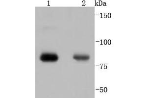 Lane 1: Hela, Lane 2: 293 lysate probed with PKC alpha(T638) (4B3) Monoclonal Antibody, Unconjugated  at 1:1000 overnight at 4˚C. (PKC alpha antibody  (pThr638))