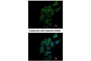 ICC/IF Image Immunofluorescence analysis of methanol-fixed Hep3B, using SIAT4A, antibody at 1:500 dilution. (ST3GAL1 antibody)