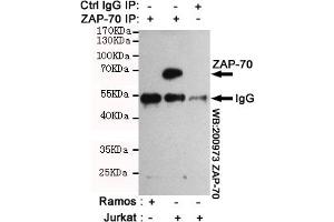 Immunoprecipitation analysis of Jurkat cell lysates (Z70 positive expression cell line)and Ramos cell lysates(Z70 negative expression cell line) using Z70 mouse mAb. (ZAP70 antibody)