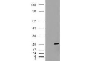 HEK293T cells were transfected with the pCMV6-ENTRY control (Left lane) or pCMV6-ENTRY BCL2L1 (RC201314) (Right lane) cDNA for 48 hrs and lysed. (BCL2L1 antibody  (AA 1-212))