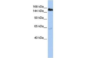 TNKS antibody used at 1 ug/ml to detect target protein. (TNKS antibody  (Middle Region))