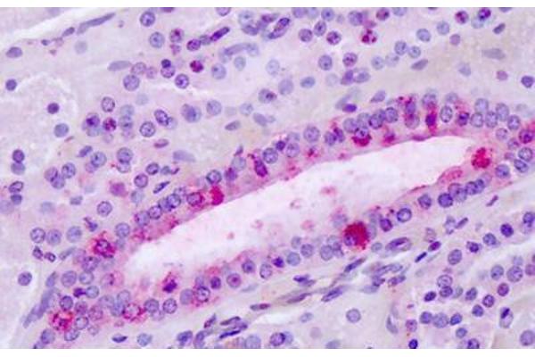 LPHN3 antibody  (C-Term)