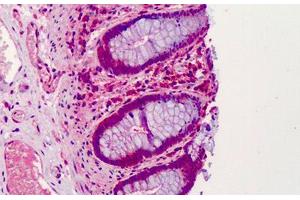 Human Colon: Formalin-Fixed, Paraffin-Embedded (FFPE) (GNAS antibody  (AA 164-394))