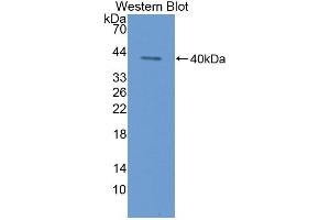 Western blot analysis of the recombinant protein. (Keratin 3 antibody  (AA 198-514))