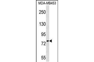 Western blot analysis in MDA-MB453 cell line lysates (35ug/lane). (PNPT1 antibody  (AA 284-311))