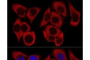Confocal immunofluorescence analysis of HeLa cells using RPL36 Polyclonal Antibody at dilution of 1:200. (RPL36 antibody)