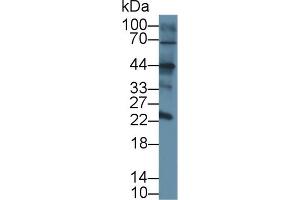 Western blot analysis of Mouse Skin, using Rabbit Anti-Mouse CLEC4L Antibody (2 µg/ml) and HRP-conjugated Goat Anti-Rabbit antibody (abx400043, 0. (DC-SIGN/CD209 antibody  (AA 115-238))