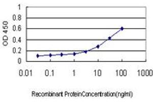 Detection limit for recombinant GST tagged RRM1 is approximately 0. (RRM1 antibody  (AA 644-753))