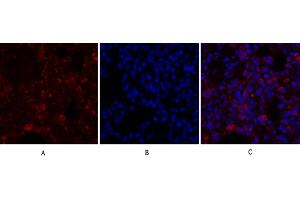 Immunofluorescence analysis of rat lung tissue. (Calnexin antibody)