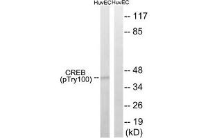 Western blot analysis of extracts from HUVEC cells, treated with etoposide (25uM, 24hours), using CREB (Phospho-Thr100) antibody. (CREB1 antibody  (pThr100))