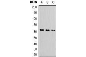 Western blot analysis of FUBP3 expression in HEK293T (A), HepG2 (B), MCF7 (C) whole cell lysates. (FUBP3 antibody)