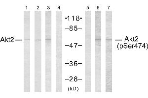 Western blot analysis using Akt2 (Ab-474) antibody (Line 1, 2, 3 and 4) and Akt2 (phospho- Ser474) antibody (Line 5, 6 and 7). (AKT2 antibody  (Ser474))