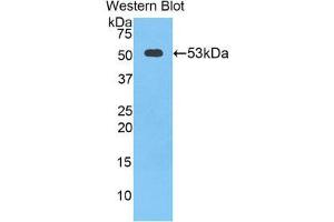 Western Blotting (WB) image for anti-Cathepsin K (CTSK) (AA 90-318) antibody (ABIN1858554) (Cathepsin K antibody  (AA 90-318))