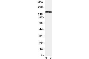 Western blot testing of COL2A1 antibody and Lane 1:  rat heart;  2: rat brain tissue lysate. (COL2A1 antibody  (C-Term))