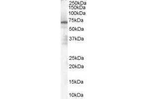 Western Blotting (WB) image for anti-Poly (ADP-Ribose) Polymerase 2 (PARP2) (Internal Region) antibody (ABIN2466070) (PARP2 antibody  (Internal Region))