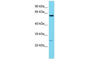 Western Blotting (WB) image for anti-Sperm Associated Antigen 7 (SPAG7) (N-Term) antibody (ABIN2505820) (SPAG7 antibody  (N-Term))