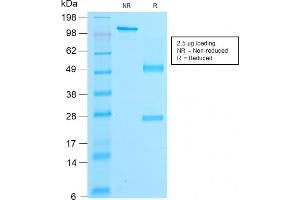 SDS-PAGE (SDS) image for anti-Catenin (Cadherin-Associated Protein), beta 1, 88kDa (CTNNB1) antibody (ABIN6939202)