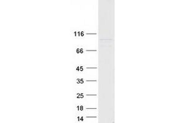 TRAK1 Protein (Transcript Variant 2) (Myc-DYKDDDDK Tag)