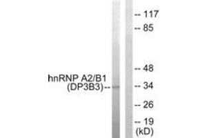 Western blot analysis of extracts from HepG2 cells, using hnRNP A2/B1 Antibody. (HNRNPA2B1 antibody  (AA 1-50))