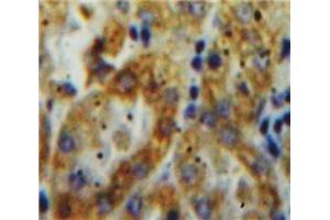 Used in DAB staining on fromalin fixed paraffin-embedded Kidney tissue (Tissue factor antibody  (AA 30-251))