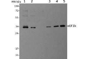 Image no. 1 for anti-Eukaryotic Translation Elongation Factor 1 beta 2 (EEF1B2) antibody (ABIN334557) (EEF1B2 antibody)