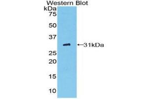 Western blot analysis of the recombinant protein. (Fc gamma RII (CD32) (AA 47-285) antibody)