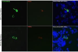 Immunofluorescence analysis of 293T cells transfected with Flag-c(mCherry) and 293T cells transfected with Flag-N(mCherry) use Rabbit anti DDDDK-Tag pAb (ABIN1512924 and ABIN5663537) at dilution of 1:50 (40x lens). (DYKDDDDK Tag antibody)