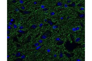 Indirect immunostaining of PFA fixed, paraffin embedded mouse brain (dilution 1 : 500; green). (Tubulin delta 2 (AA 443-449) antibody)