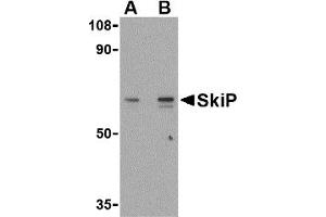 Western Blotting (WB) image for anti-SKIP (C-Term) antibody (ABIN1030669) (SKIP (C-Term) antibody)