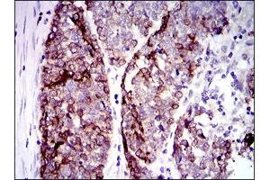 Immunohistochemistry (IHC) image for anti-Keratin 5 (KRT5) (AA 316-590) antibody (ABIN1724789)