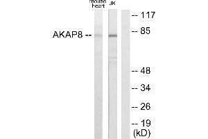 Immunohistochemistry analysis of paraffin-embedded human heart tissue using AKAP8 antibody. (AKAP8 antibody)