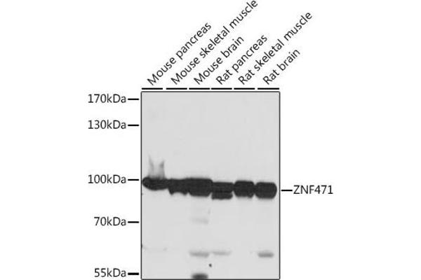 ZNF471 Antikörper  (AA 80-210)