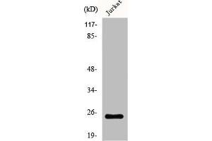 Western Blot analysis of Jurkat cells using AK5 Polyclonal Antibody (Adenylate Kinase 5 antibody  (C-Term))