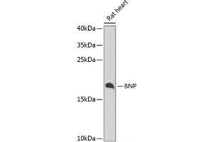 Western blot analysis of extracts of Rat heart using BNP Polyclonal Antibody at dilution of 1:1000. (BNP antibody)