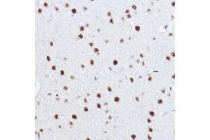 Immunohistochemistry of paraffin-embedded rat brain using p73 Rabbit mAb (ABIN1678945, ABIN1678944, ABIN7101487 and ABIN7101488) at dilution of 1:100 (40x lens). (Tumor Protein p73 antibody)