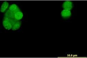 Image no. 3 for anti-Progesterone Receptor (PGR) (AA 1-111) antibody (ABIN598869) (Progesterone Receptor antibody  (AA 1-111))