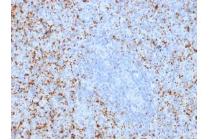 Formalin-fixed, paraffin-embedded human Spleen stained with CD61 Mouse Monoclonal Antibody (ITGB3/2145). (Integrin beta 3 antibody  (AA 385-490))