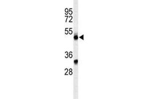 Western blot analysis of CFP antibody and CEM lysate. (CFP antibody  (AA 197-223))
