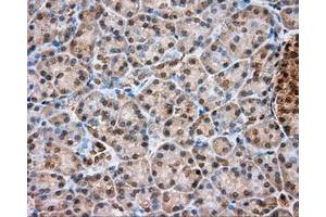 Immunohistochemistry (IHC) image for anti-Thiopurine S-Methyltransferase (TPMT) antibody (ABIN1501480) (TPMT antibody)