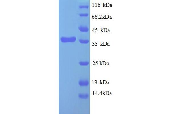 PAP Associated Domain Containing 7 (PAPD7) (AA 723-1012), (partial) protein (His tag)