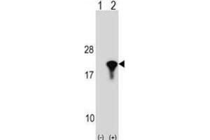 Western Blotting (WB) image for anti-Peptidylprolyl Isomerase (Cyclophilin)-Like 1 (PPIL1) antibody (ABIN2998971) (PPIL1 antibody)