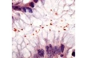 Formalin fixed paraffin embedded human stomach infected with H. (Helicobacter Pylori antibody)