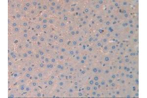 IHC-P analysis of Rat Liver Tissue, with DAB staining. (CA2 antibody)