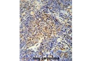 Immunohistochemistry (IHC) image for anti-OTU Domain Containing 4 (OTUD4) antibody (ABIN3002507) (OTUD4 antibody)