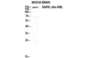 Western Blotting (WB) image for anti-Death-Associated Protein Kinase 1 (DAPK1) (Ser296) antibody (ABIN3184249) (DAP Kinase 1 antibody  (Ser296))