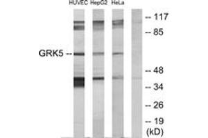 Western Blotting (WB) image for anti-G Protein-Coupled Receptor Kinase 5 (GRK5) (AA 351-400) antibody (ABIN2889456) (GRK5 antibody  (AA 351-400))
