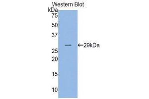 Western Blotting (WB) image for anti-Adenosine Kinase (ADK) (AA 94-339) antibody (ABIN1857921) (ADK antibody  (AA 94-339))