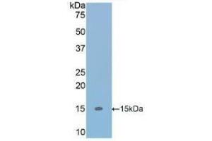 Detection of Recombinant TGFb1, Human using Polyclonal Antibody to Transforming Growth Factor Beta 1 (TGFb1) (TGFB1 antibody  (AA 279-390))