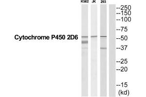 Western Blotting (WB) image for anti-Cytochrome P450, Family 2, Subfamily D, Polypeptide 6 (CYP2D6) (Internal Region) antibody (ABIN1852659) (CYP2D6 antibody  (Internal Region))