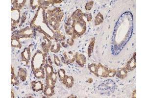 Immunohistochemistry (IHC) image for anti-Keratin 8 (KRT8) (C-Term) antibody (ABIN870549) (KRT8 antibody  (C-Term))